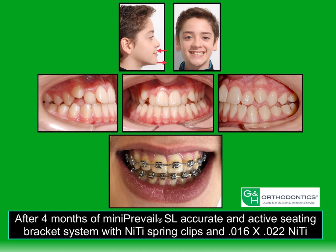 Original slide with clinical before-and-after photos packed edge to edge